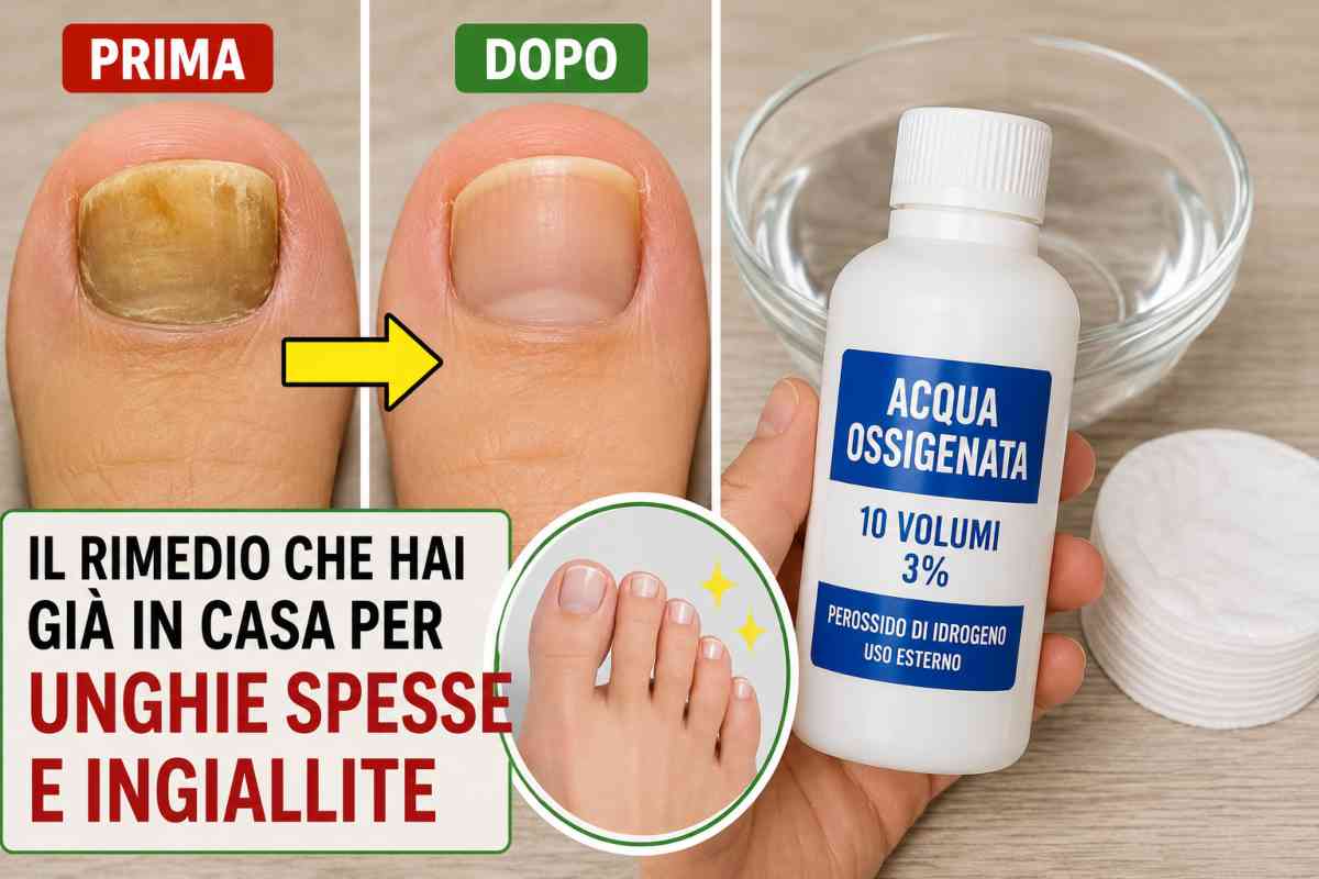 Unghie la soluzione ad 1 euro LSDI.it
