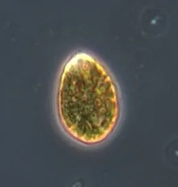 Cellula di Ostreopsis cf. ovata osservata al microscopio