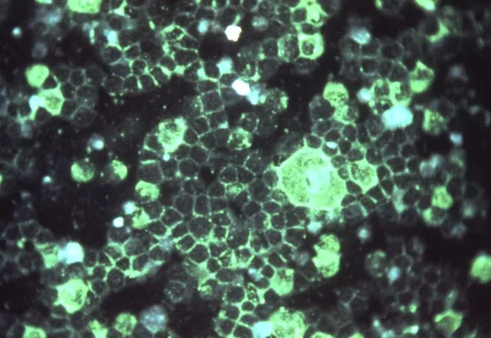 Micrografia del virus respiratorio sinciziale VRS al microscopio