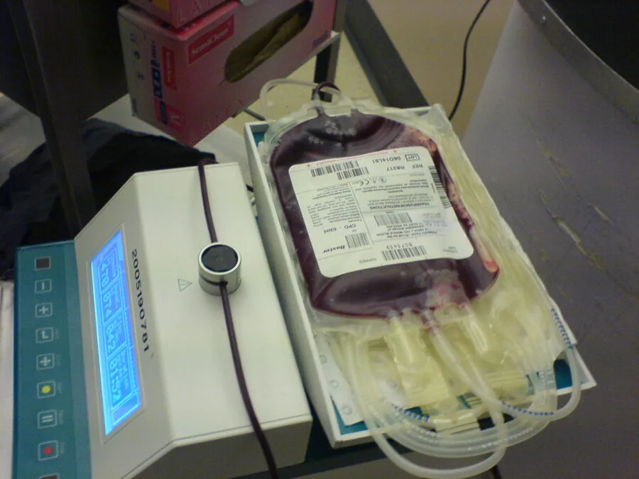 Sacca di sangue collegata ad apparecchiatura per raccolta trasfusionale