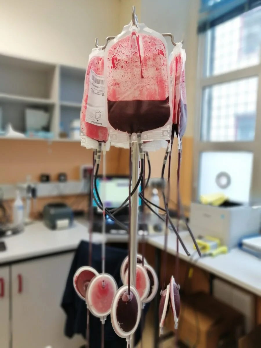 Sacche di sangue in laboratorio per controlli e sicurezza trasfusionale