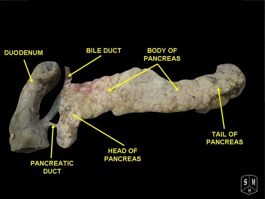 Pancreas umano sezionato con le principali strutture anatomiche indicate