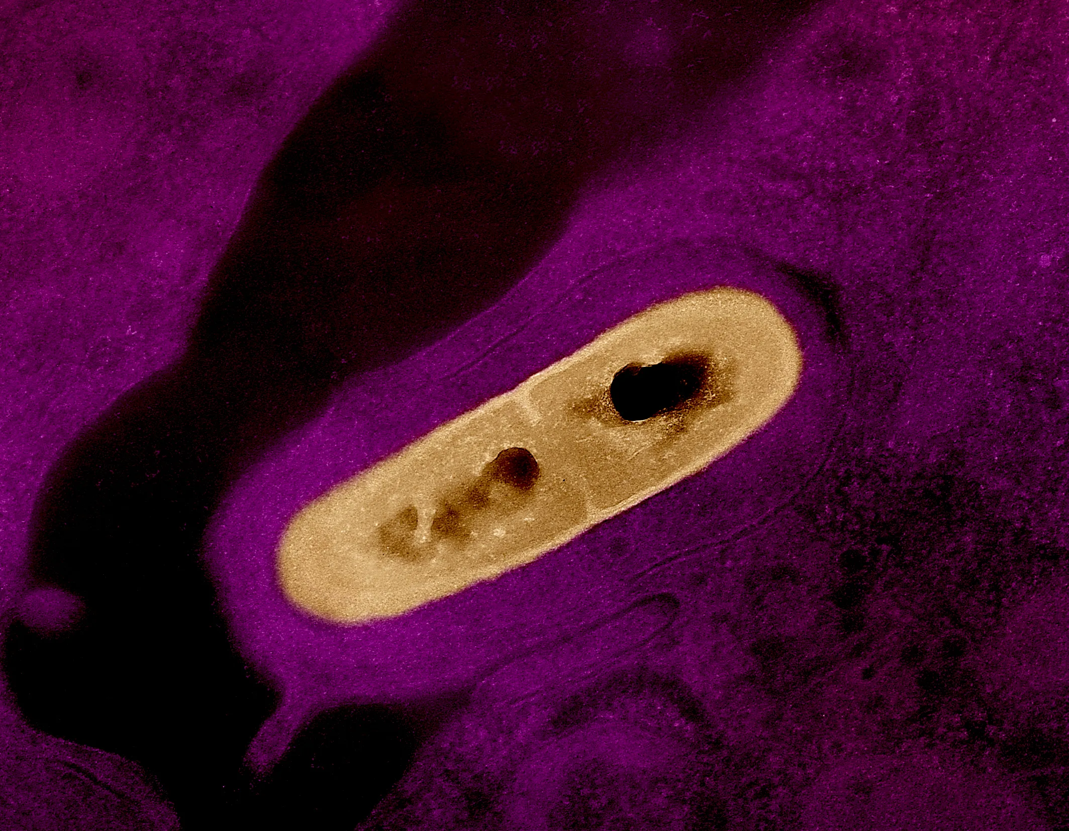 Micrografia colorizzata di un batterio Listeria in un tessuto, immagine scientifica illustrativa